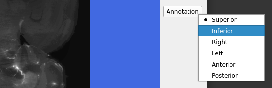../../../_images/MIRACL_workflows_clar-reg_orientation_annotation_1.png