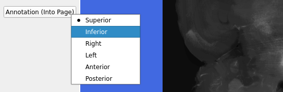 ../../../_images/MIRACL_workflows_clar-reg_orientation_annotation_2_into-page.png