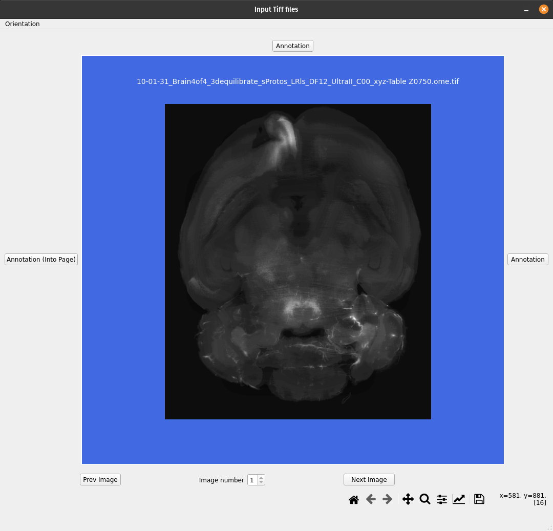 ../../../_images/MIRACL_workflows_clar-reg_orientation_menu.png