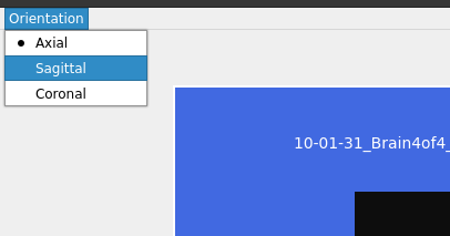 ../../../_images/MIRACL_workflows_clar-reg_orientation_orientation.png